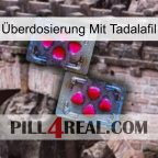 Überdosierung Mit Tadalafil 15